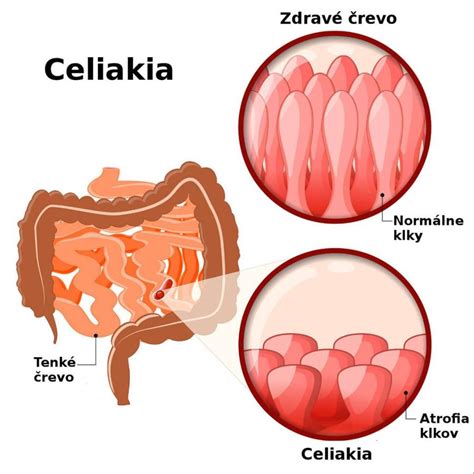 Schematické znázornenie častí gule