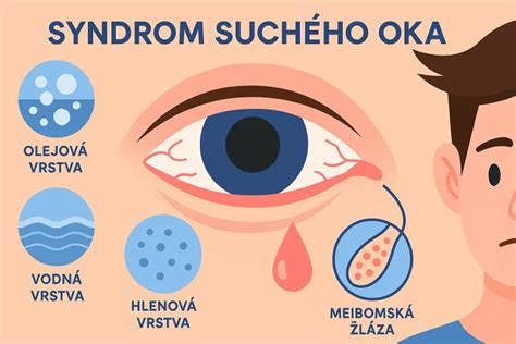 Ilustrácia suchého kašľa a jeho symptómov