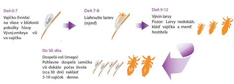 Ilustrácia detskej vši