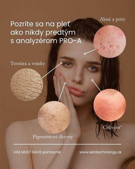 Detailný pohľad na textúru pokožky odranca
