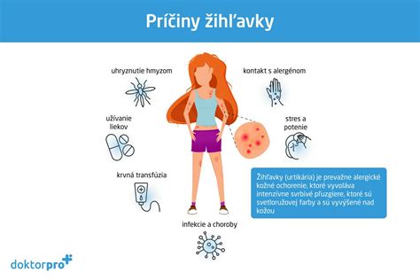 Ilustrácia žihľavky na koži
