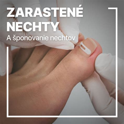 Príprava nechtov pred lakovaním