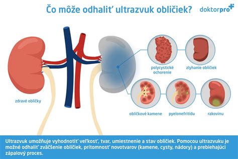 fotografia pripravených očistených bravčových obličiek