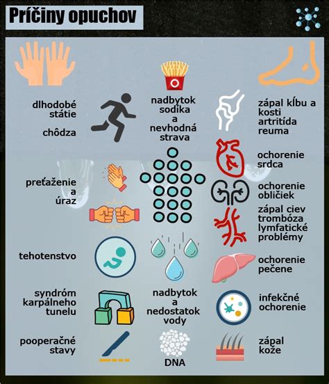 Infografika zobrazujúca rôzne príčiny opuchov nôh a ich riešenia