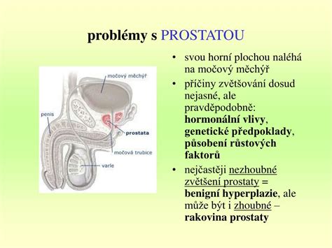 Ilustrácia mužského močového systému s prostatou
