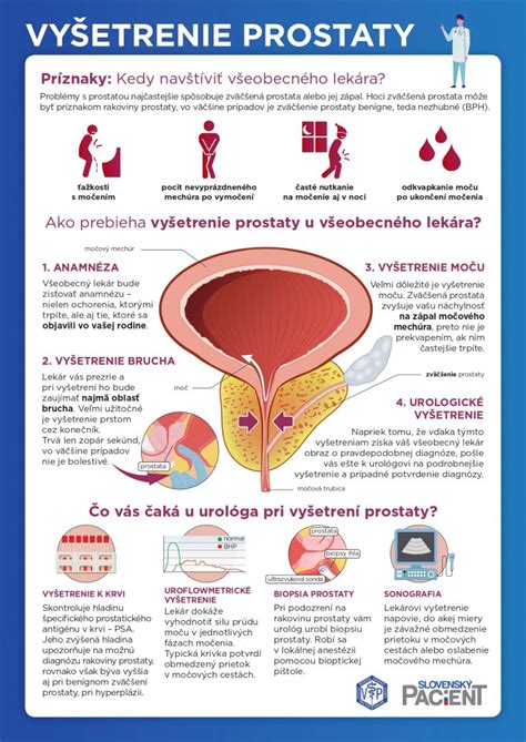 Schéma liečby benígnej hyperplázie prostaty